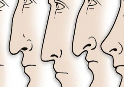 ​Nâng mũi, sửa mũi có ảnh hưởng đến tướng số không?